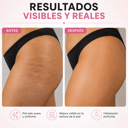 Crema viral - Reafirma las celulitis y estrias